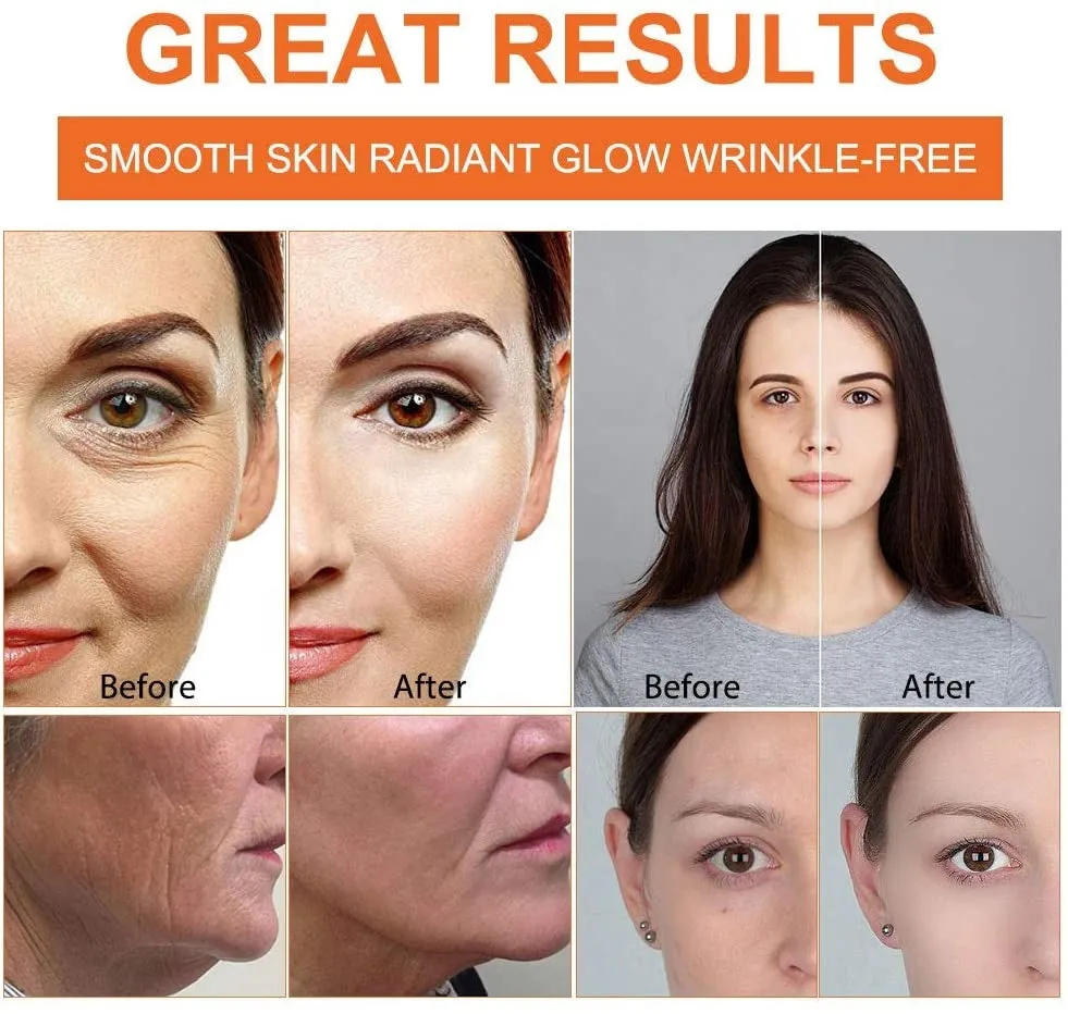 Anti-Aging & Anti-Wrinkle 20% Vitamin C Serum – Plant-Based Face Serum, 30ml