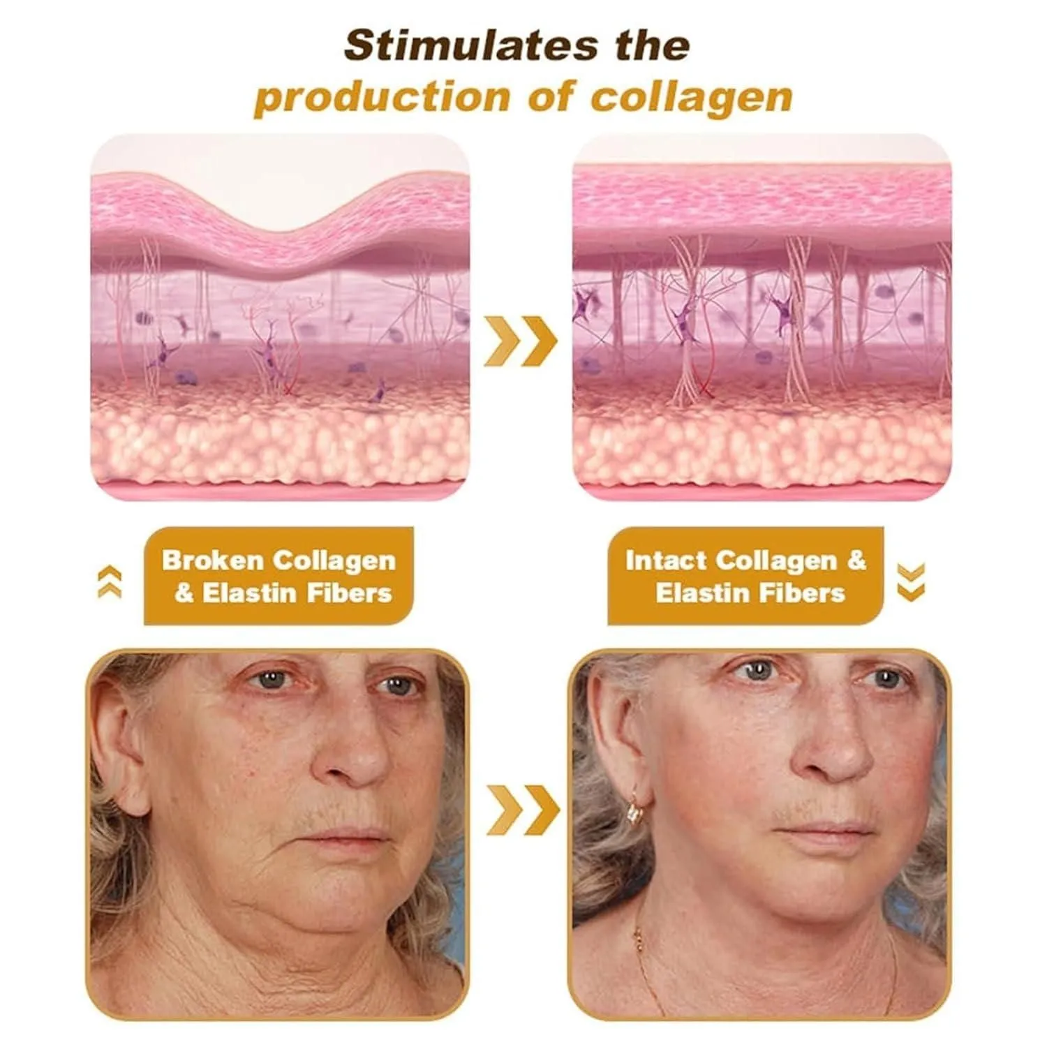 BeeTox - Bee Venom Wrinkle Repair Cream   Buy 1 Get 2